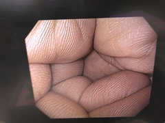 上部消化管汎用ビデオスコープ｜GIF-Q150X｜オリンパスメディカルシステムズ株式会社の写真7枚目