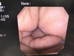 上部消化管汎用ビデオスコープ(径鼻)｜GIF-XP150N｜オリンパスメディカルシステムズ株式会社の写真7枚目