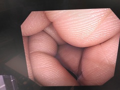大腸ビデオスコープ｜CF-Q260AI｜オリンパスメディカルシステムズ株式会社の写真7枚目