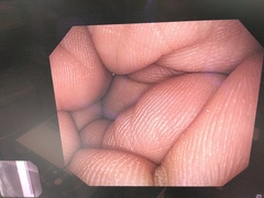 上部消化管汎用ビデオスコープ｜GIF-Q260｜オリンパスメディカルシステムズ株式会社の写真7枚目