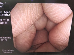 大腸ビデオスコープ｜CF-Q260DI｜オリンパスメディカルシステムズ株式会社の写真7枚目