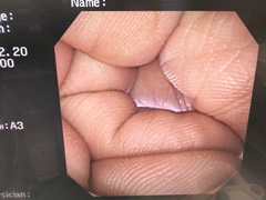 Video Gastroscope｜GIF-XP260NS｜Olympus Medical Systems photo7