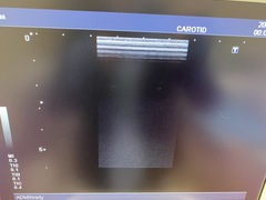 超音波診断装置（カラードプラ）｜SSA-580A Nemio XG｜キヤノンメディカルシステムズの写真7枚目