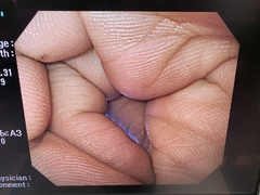 Video Gastroscope｜GIF-Q240｜Olympus Medical Systems photo7