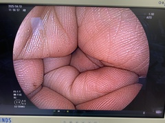 Video Gastroscope｜EG-590WR2｜Fujifilm Medical photo7