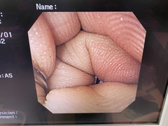 Video Gastroscope｜GIF-XK240｜Olympus Medical Systems photo7
