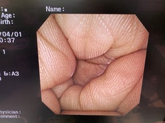 Video Gastroscope｜GIF-XP260NS｜Olympus Medical Systems photo7