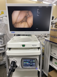 上部消化管スコープ｜EG16-K10｜ペンタックスの写真7枚目