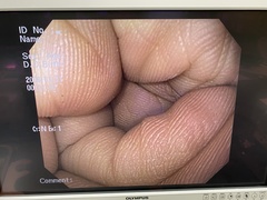 Video Gastroscope｜GIF-Q150X｜Olympus Medical Systems photo7
