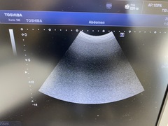 Ultrasound System(Color)｜Xario100 TUS-X100｜Canon Medical Systems photo7