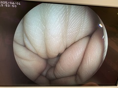 Video Colonoscope｜EC-250WM｜Fujifilm Medical photo7