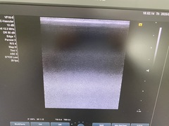 Ultrasound system｜ACUSON X700｜Mochida Siemens Medical Systems photo7