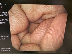 Video Gastroscope｜GIF-H260｜Olympus Medical Systems photo7