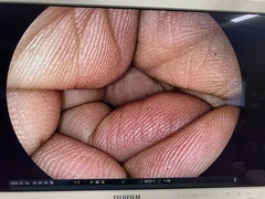 上部消化管ビデオスコープ｜EG-590WR｜富士フイルムメディカルの写真7枚目