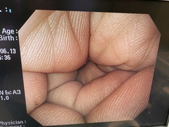 Video Gastroscope｜GIF-PQ260｜Olympus Medical Systems photo7