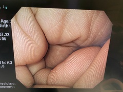 上部消化管汎用ビデオスコープ｜GIF-H260｜オリンパスメディカルシステムズ株式会社の写真7枚目
