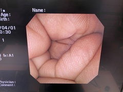 Video Gastroscope｜GIF-XP260NS｜Olympus Medical Systems photo7