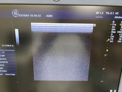 Ultrasound system(Color)｜LOGIQ P6｜GE Healthcare photo7