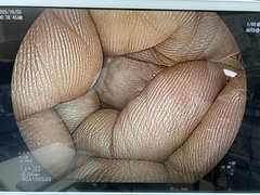 Video Transnasal Gastroscope｜EG-L580NW7｜Fujifilm Medical photo7