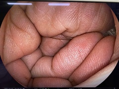 Video Transnasal Gastroscope｜EG-530NW｜Fujifilm Medical photo7