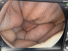 上部消化管用経鼻スコープ｜EG-L580NW7｜富士フイルムメディカルの写真7枚目