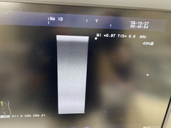 Ultrasound system｜F37｜Hitachi photo7