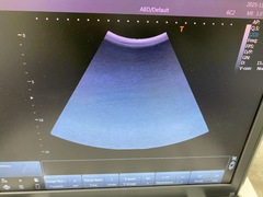 Ultrasound system｜Viamo α100　TUS-VC100｜Canon Medical Systems photo7