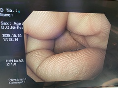 Video Gastroscope｜GIF-H260｜Olympus Medical Systems photo7