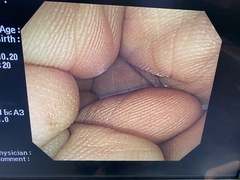 Video Colonoscope｜PCF-Q260AI｜Olympus Medical Systems photo7