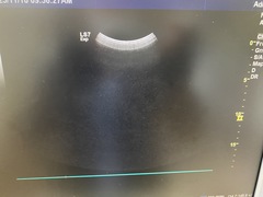 超音波診断装置｜LOGIQ S7 Expert｜GEヘルスケアの写真7枚目