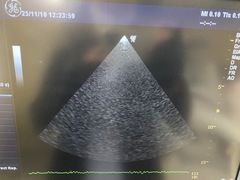 超音波診断装置（カラードプラ）｜LOGIQ P6｜GEヘルスケアの写真7枚目