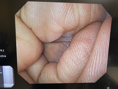 Video Gastroscope｜GIF-Q260｜Olympus Medical Systems photo7