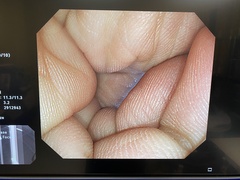 Video Colonoscope｜PCF-Q260AI｜Olympus Medical Systems photo7