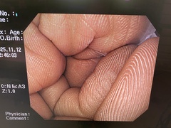 上部消化管汎用ビデオスコープ｜GIF-Q260｜オリンパスメディカルシステムズ株式会社の写真7枚目