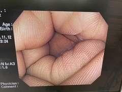 Video Colonoscope｜PCF-Q260AZI｜Olympus Medical Systems photo7