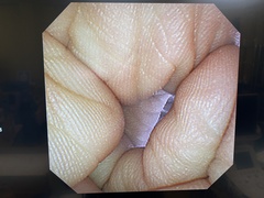 Video Transnasal Gastroscope｜GIF-XP260N｜Olympus Medical Systems photo7