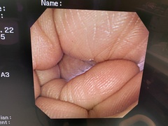 Video Gastroscope｜GIF-XP260NS｜Olympus Medical Systems photo7