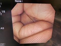 Video Gastroscope｜GIF-XP260NS｜Olympus Medical Systems photo7