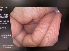 上部消化管汎用ビデオスコープ｜GIF-Q260｜オリンパスメディカルシステムズ株式会社の写真7枚目