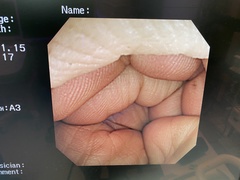 Video Colonoscope｜CF-240AL｜Olympus Medical Systems photo7