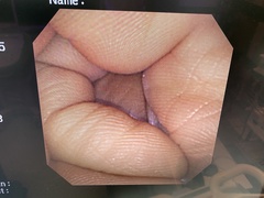 Video Gastroscope｜GIF-XP260｜Olympus Medical Systems photo7