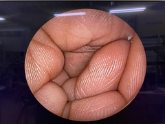 Video Transnasal Gastroscope｜EG-530N2｜Fujifilm Medical photo7