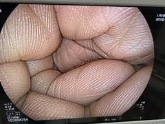 Video Gastroscope｜EG-L590WR｜Fujifilm Medical photo7