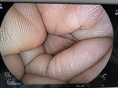 Video Gastroscope｜EG-L590WR｜Fujifilm Medical photo7