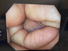 大腸ビデオスコープ｜CF-H290I｜オリンパスメディカルシステムズ株式会社の写真7枚目