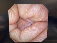 Video Gastroscope｜GIF-XP260NS｜Olympus Medical Systems photo7