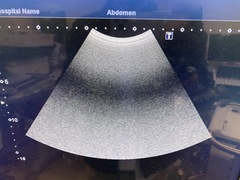 超音波診断装置｜Aplio 500 TUS-A500｜キヤノンメディカルシステムズの写真7枚目