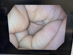 上部消化管汎用ビデオスコープ｜GIF-H190N｜オリンパスメディカルシステムズ株式会社の写真7枚目