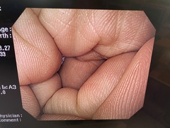 Video Gastroscope｜GIF-H260｜Olympus Medical Systems photo7