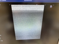 Ultrasound System(Color)｜Xario100 TUS-X100｜Canon Medical Systems photo7